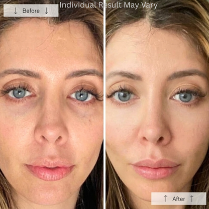 HAPPSTA™ SkinRevive Mask